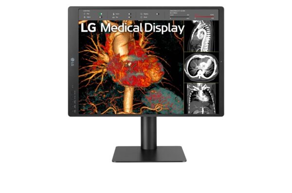 Monitor de Diagnóstico LG 21.3" 3MP 21HQ513D - Imagen 2
