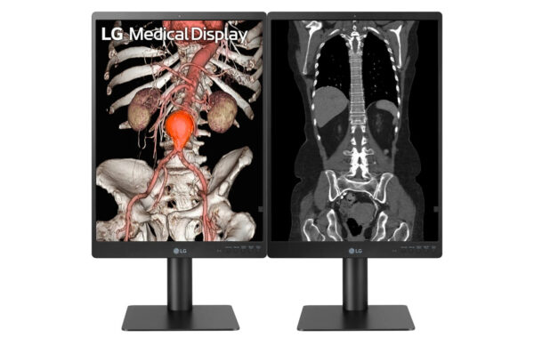 Monitor de Diagnóstico LG 21.3" 3MP 21HQ513D - Imagen 7