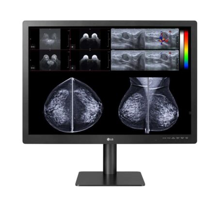 Monitor de Diagnóstico LG 31'' 12MP para mamografía 31HN713D