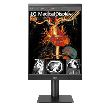 Monitor de Diagnóstico LG 21.3" 3MP 21HQ513D