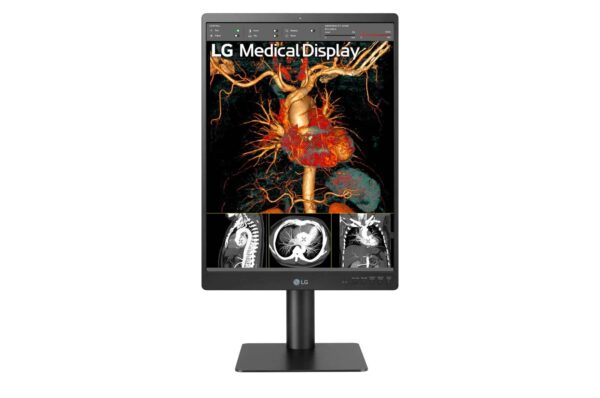 Monitor de Diagnóstico LG 21.3" 3MP 21HQ513D