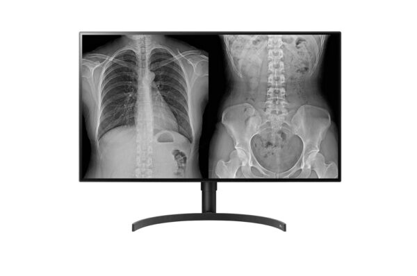 Monitor de Diagnóstico LG 31.5" 8MP 32HL512D-B