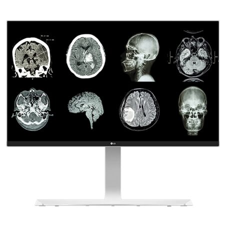 Monitor de revisión clínica LG 27" 8MP 27HJ712C
