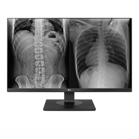 Monitor de revisión clínica LG 27" 8MP 27HJ713C