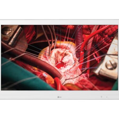 Monitor Quirúrgico LG 27'' Full HD IPS 27HK510S