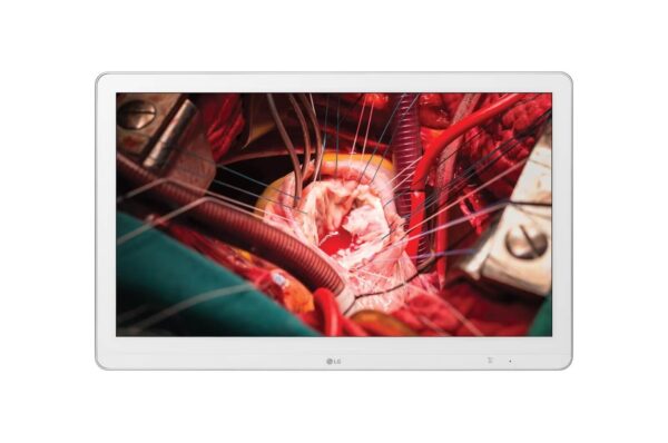 Monitor Quirúrgico LG 27'' Full HD IPS 27HK510S