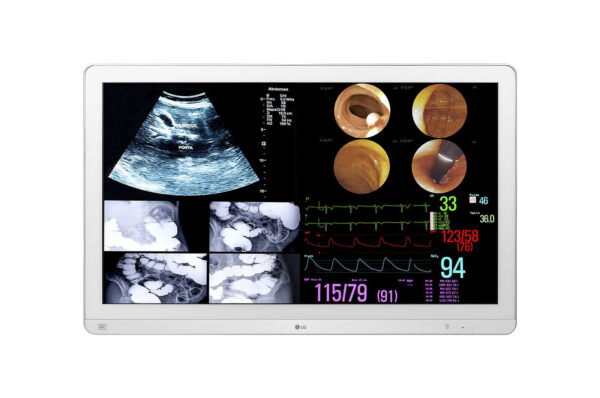 Monitor Quirúrgico LG 31.5'' 4K IPS 32HL714S
